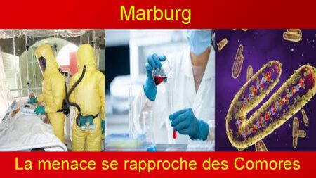 Les Comores sont en alerte, le virus de Marburg, un cousin encore plus dangereux d'Ebola, est présent sur leur territoire. Les autorités sanitaires sont sur le qui-vive.